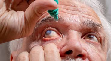 Tratamento de Doenças Oculares